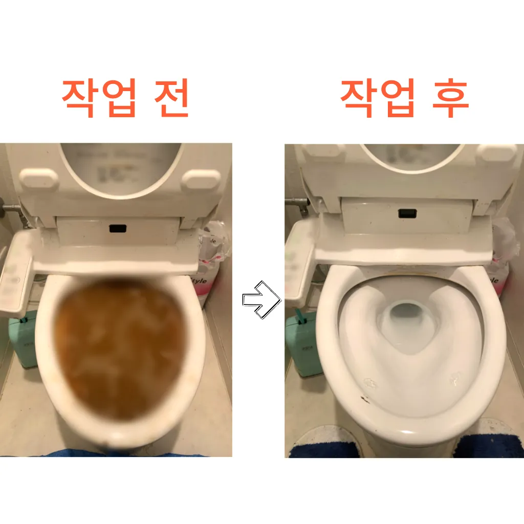 김포변기막힘